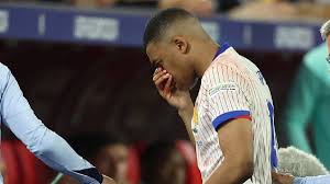 Mbappe Suffers Nose Injury